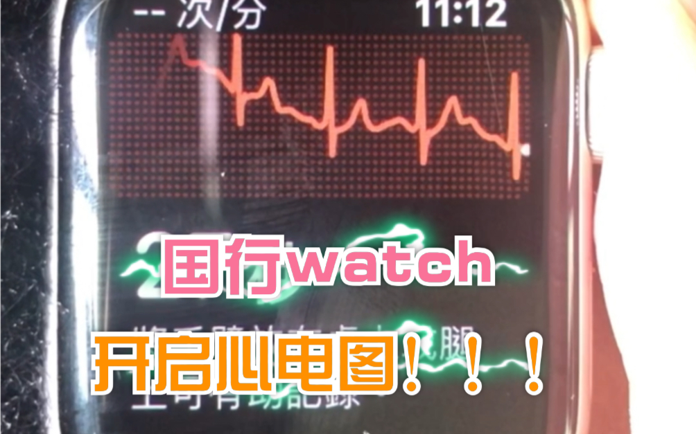 【实测】国行watch开通ecg!心电图功能_哔哩哔哩_bilibili