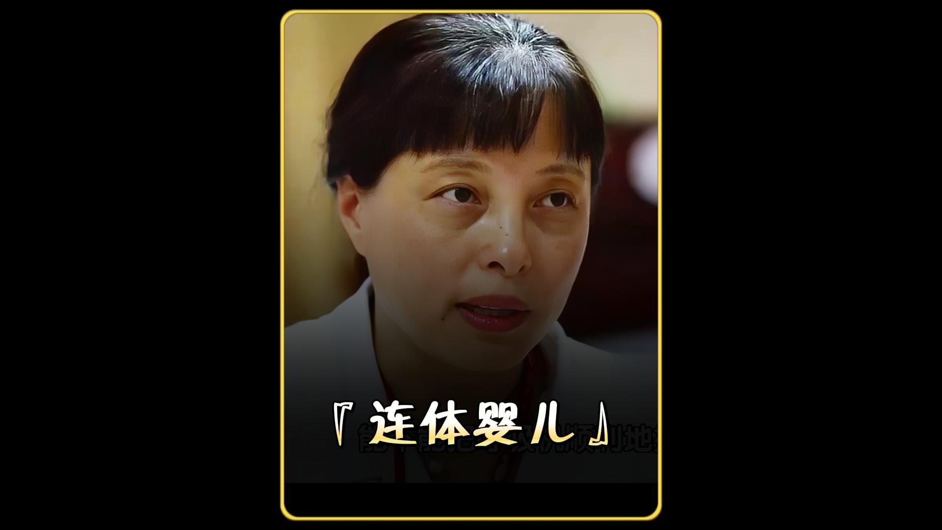 双胞胎姐妹臀部相连,共用一个肛门,医院举全院之力进行拯救哔哩哔哩bilibili