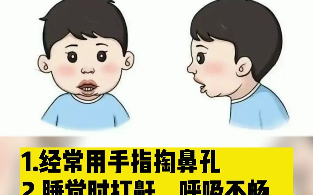 腺樣體面容不可逆,腺樣體肥大保守就能縮小