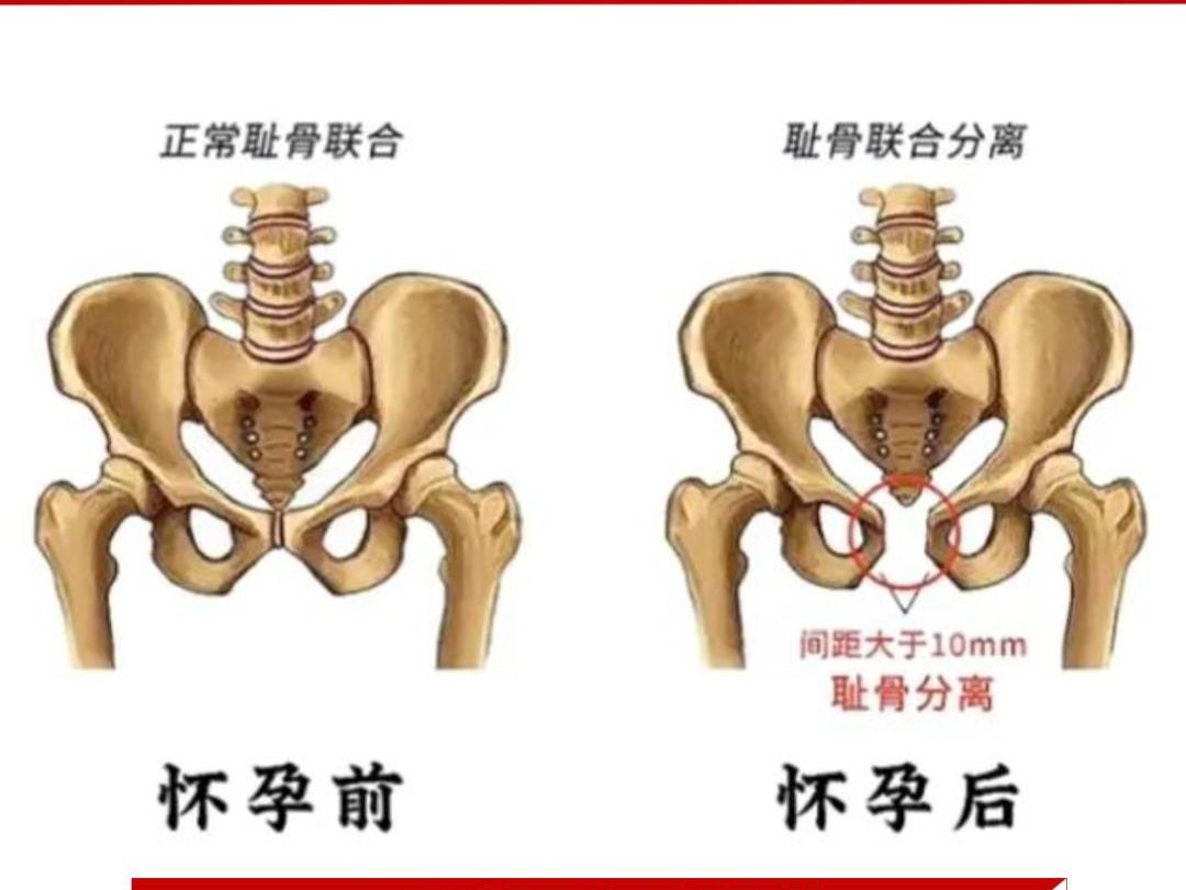 孕妇耻骨准确位置图片图片