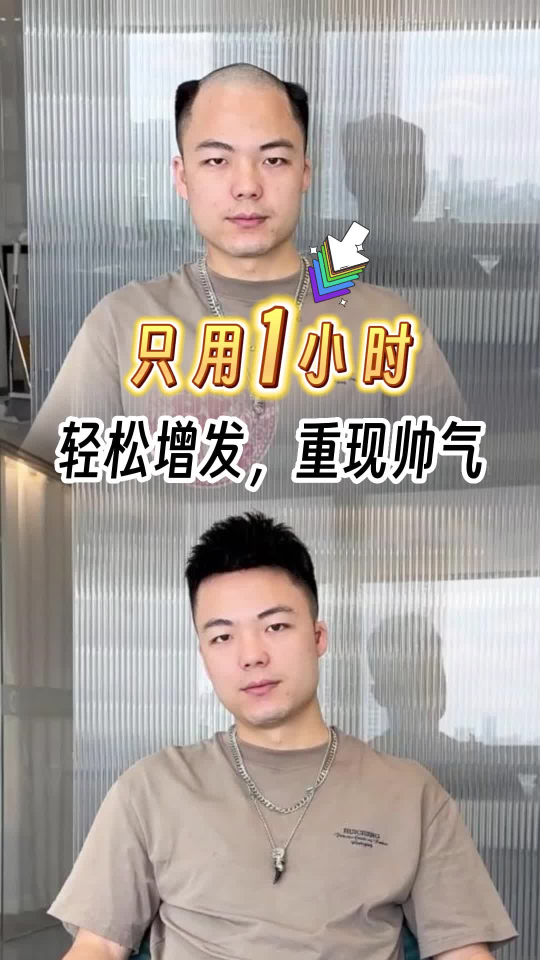 深圳假发店怎么选?深圳男士假发专卖店,可提供逼真男士假发;假发片定制,时尚减龄,品质可靠.哔哩哔哩bilibili