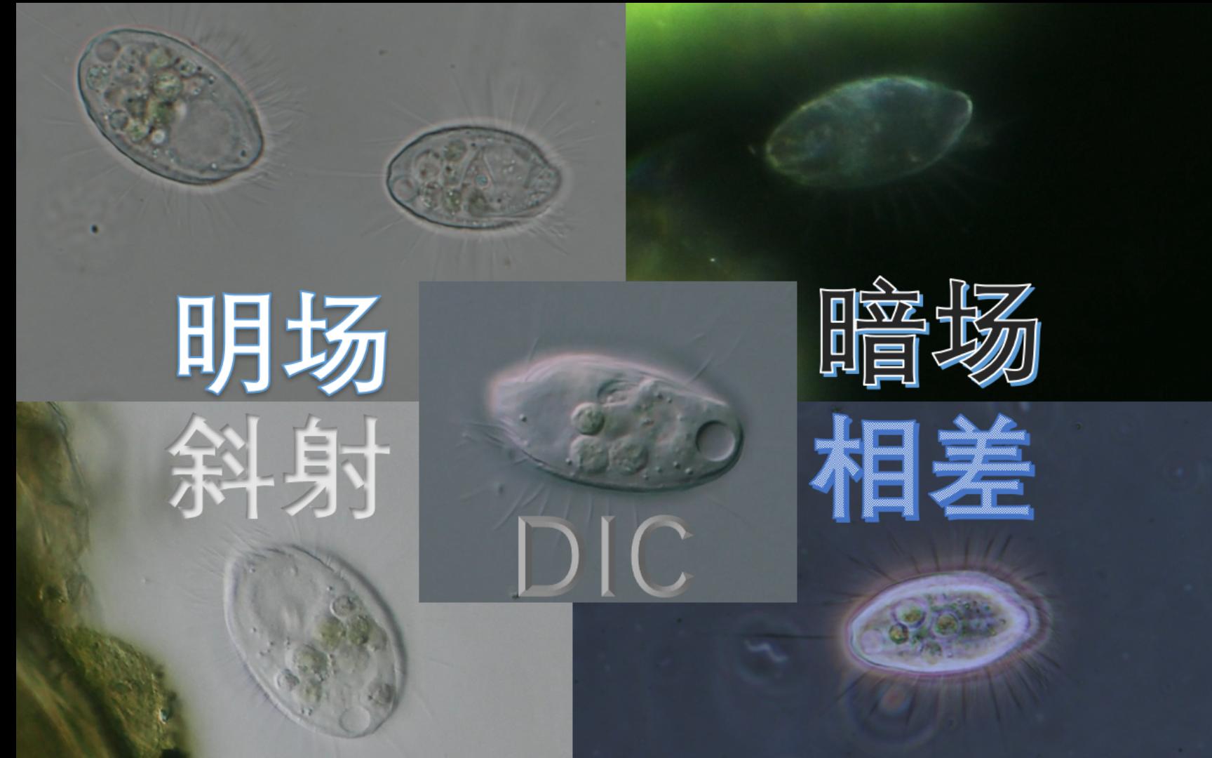 【明场、暗场、斜射、DIC、相差】五种常见的显微镜照明模式哔哩哔哩bilibili