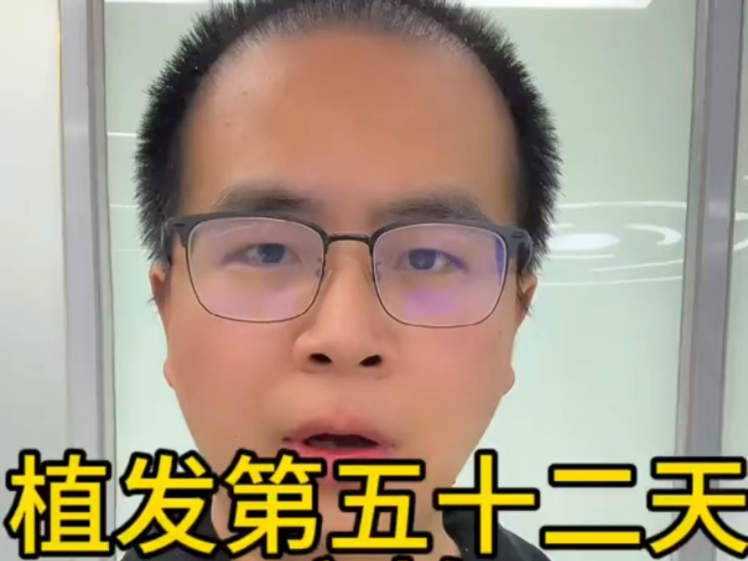 植发需日记(植发日记视频)