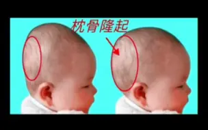 Tải video: 骨相学  枕骨凸出者日后必成大器，千万不要睡平了！