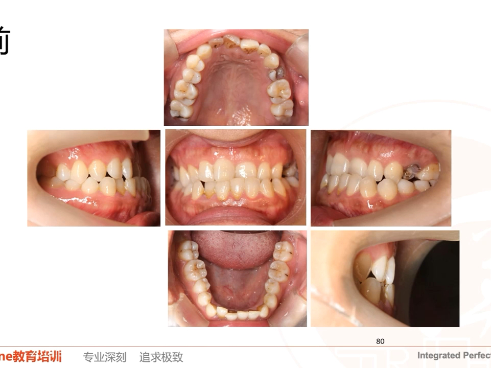 正畸基础理论系列课程——胡开明哔哩哔哩bilibili