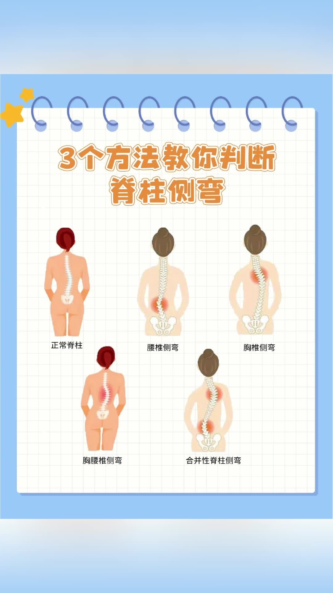 3个方法教你自测脊柱侧弯哔哩哔哩bilibili