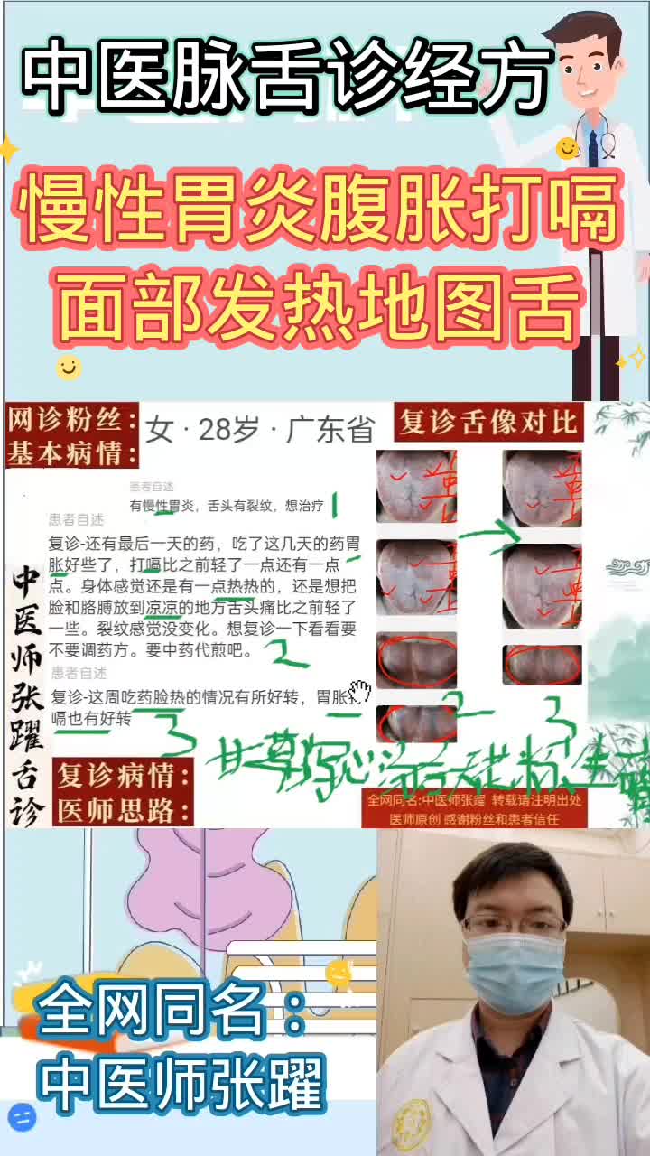 [图]简单舌诊案例十七 慢性胃炎腹胀打嗝面部发热 两次中医师张躍舌诊