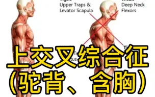 Скачать видео: 解决你的圆肩、驼背、厚肩、斜方肌厚（最全解剖详解）