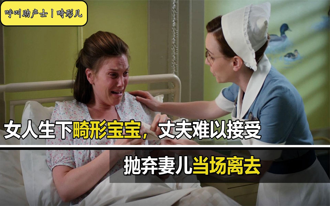 《呼叫助产士》:女人生下畸形宝宝,丈夫难以接受,当场抛弃妻儿