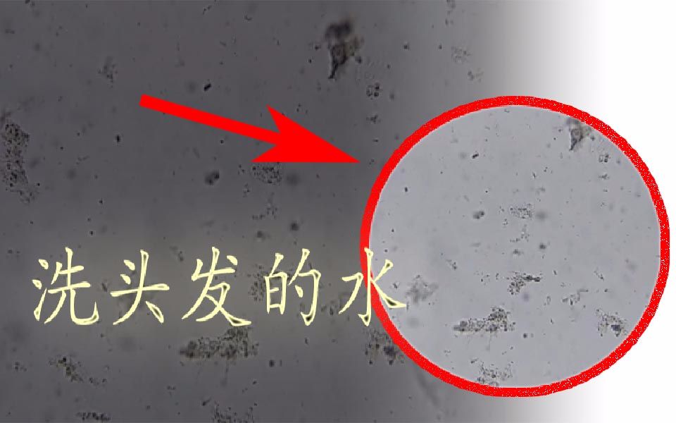 显微镜下的洗头水放大1000倍后居然有这么多东西