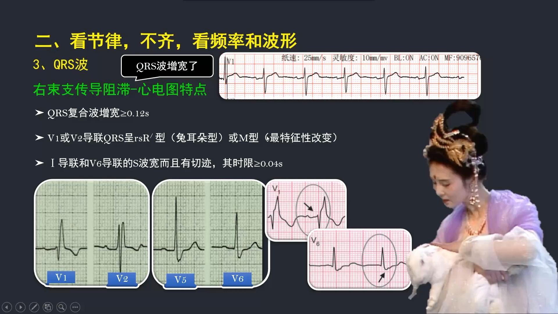 速记内科学心电图(6)哔哩哔哩bilibili