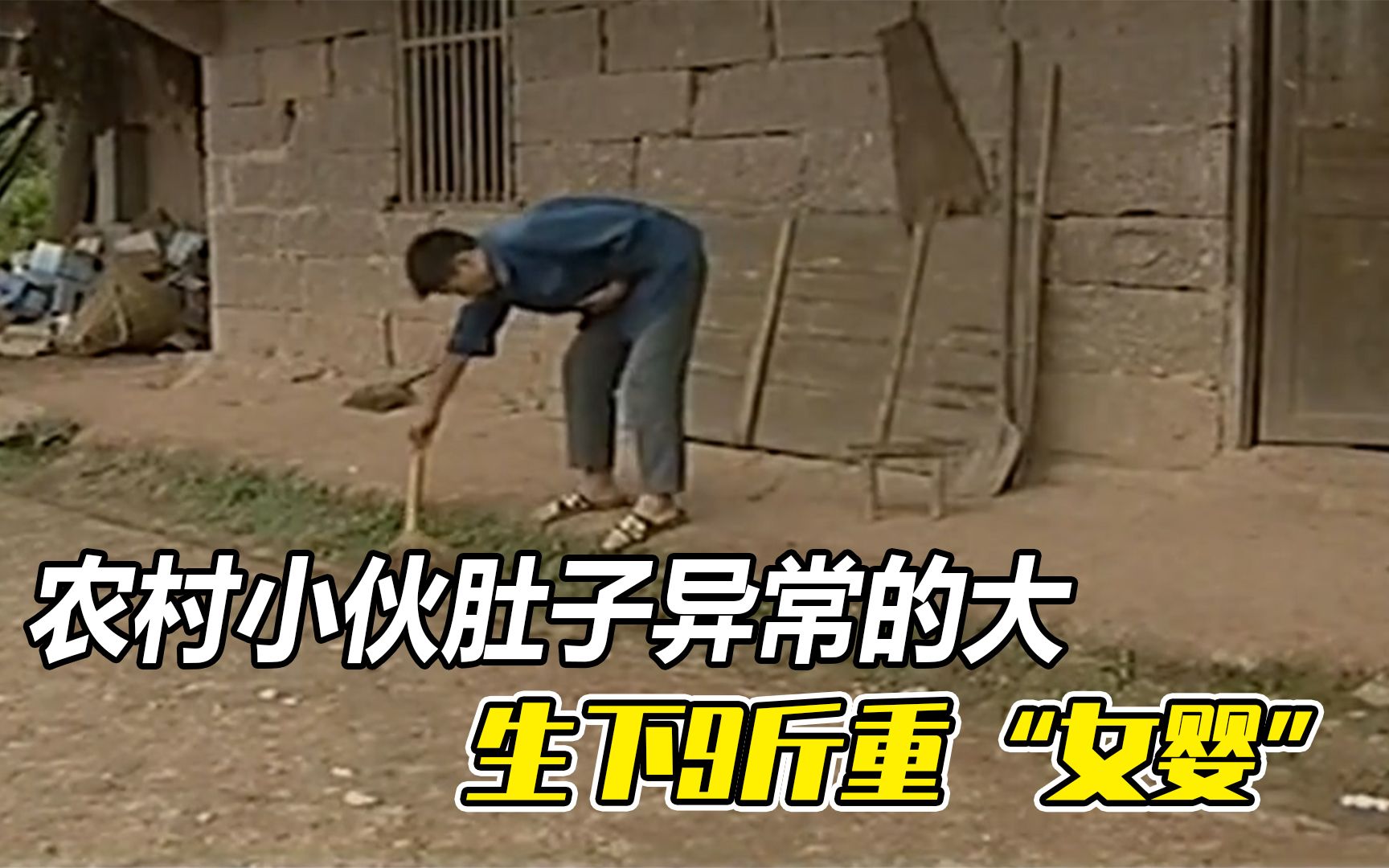 农村小伙肚子异常的大生下9斤重女婴有手有脚还有毛发