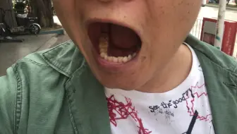 看看这洗牙之后的牙口，很健康嘛，不酸，不疼，没有红肿