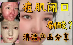 Download Video: 黑头闭口痘肌？面部皮肤清洁产品分享测评 | 刷酸水杨酸 | 痘印毛孔粗大护肤 | 清角质油脂