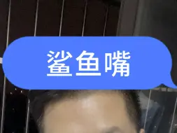 Descargar video: 当指甲张开鲨鱼一样的嘴，你的脚趾头怕吗？