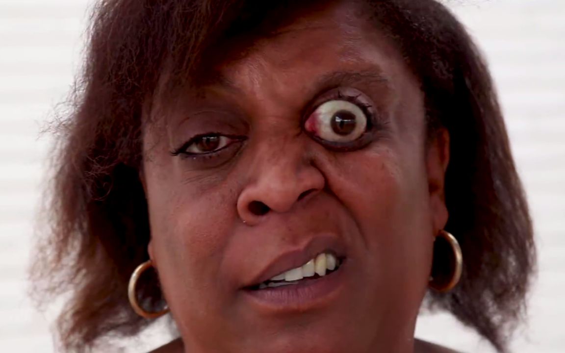 世界上最惊悚的纪录眼睛向外突出11毫米外星人的既视感