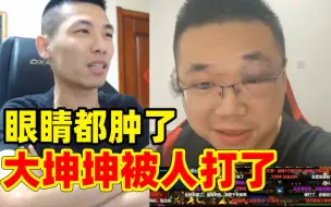 Download Video: 大坤坤被人打了！眼睛都打肿了！宝哥看了都生气！