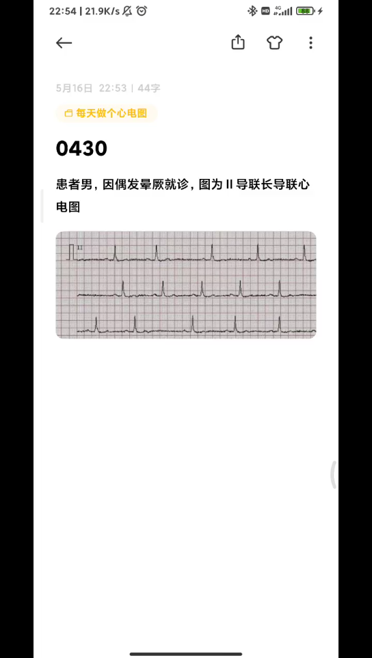 0430每天一份心电图,窦性停搏哔哩哔哩bilibili