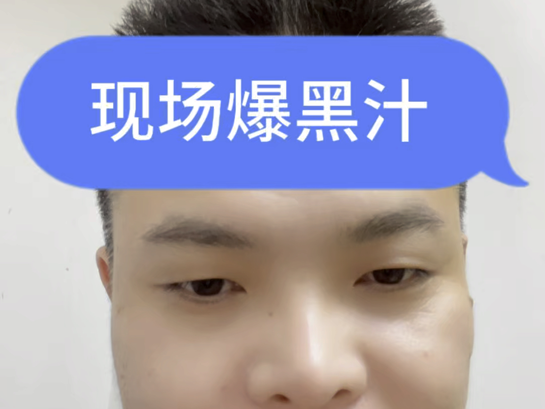 爆黑浆哔哩哔哩bilibili