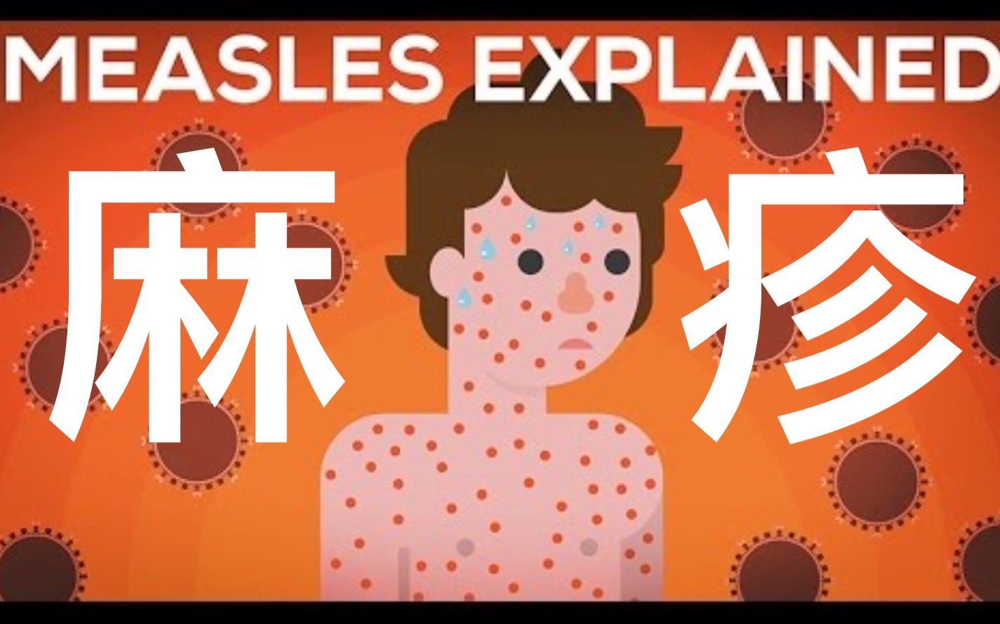 [图]【Kurzgesagt】双语·麻疹详解：我们需要接种疫苗吗 Measles Explained Vaccinate Or Not