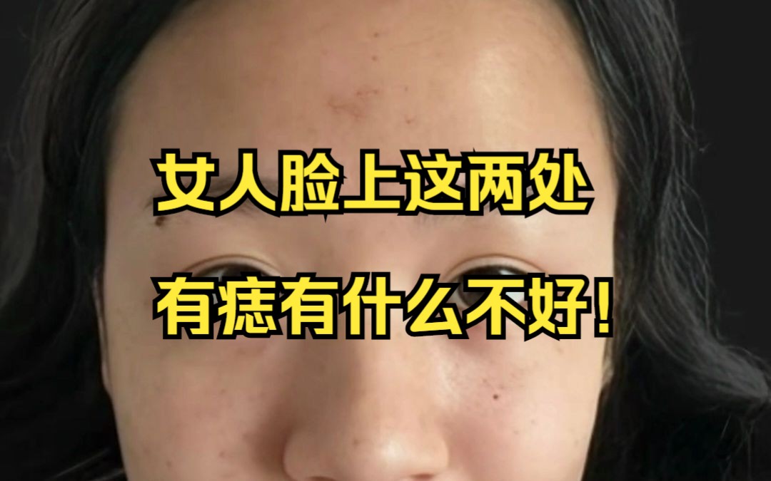 女人脸上这两处有痣有什么不好!哔哩哔哩bilibili