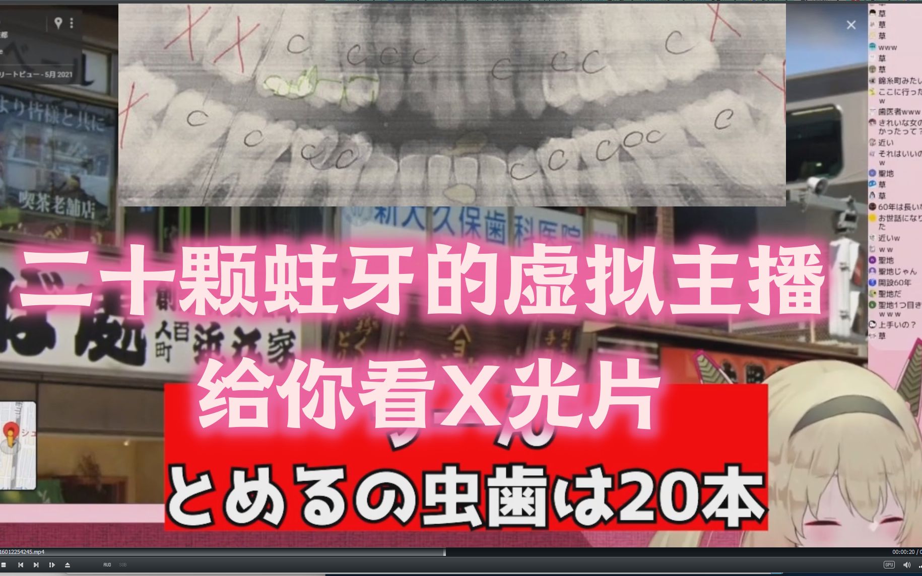 虚拟主播20颗蛀牙的X光片【息根とめる】哔哩哔哩bilibili