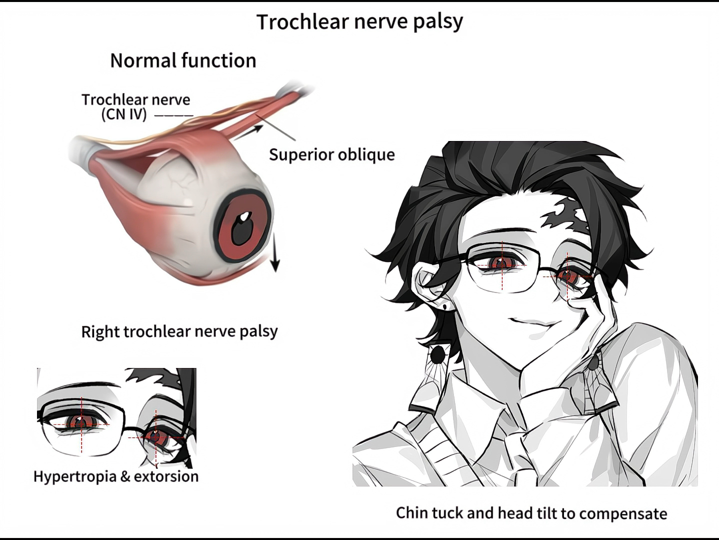 炭治郎 斜视meme【B萌应援】