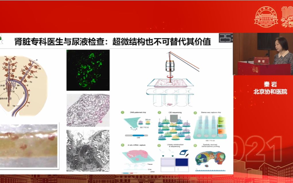 读懂尿液检验临床医生的基本功哔哩哔哩bilibili