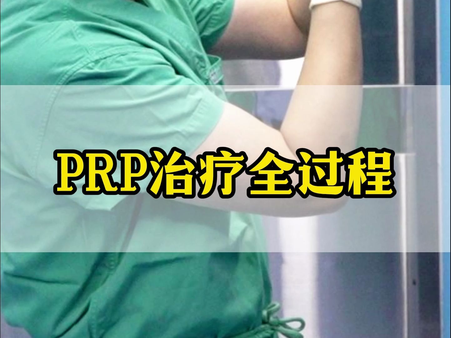 打PRP治疗全程记录(一)哔哩哔哩bilibili