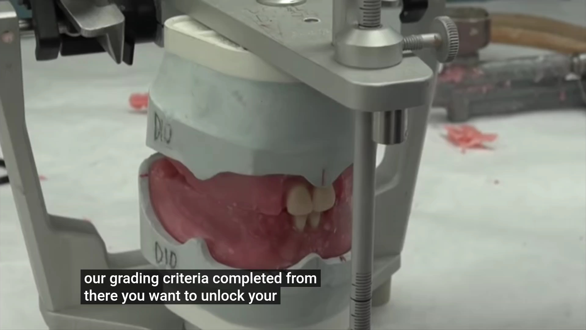 全口义齿排牙2(前牙)