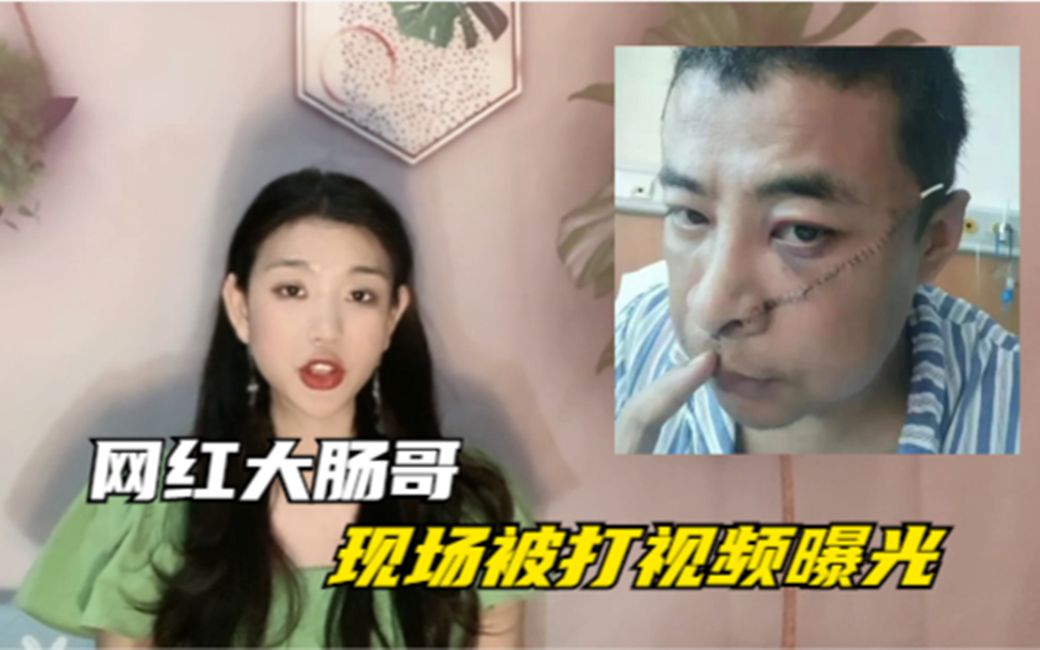 [图]网红大肠哥与人发生口角的视频曝光！脸上因此留下了长长的刀疤