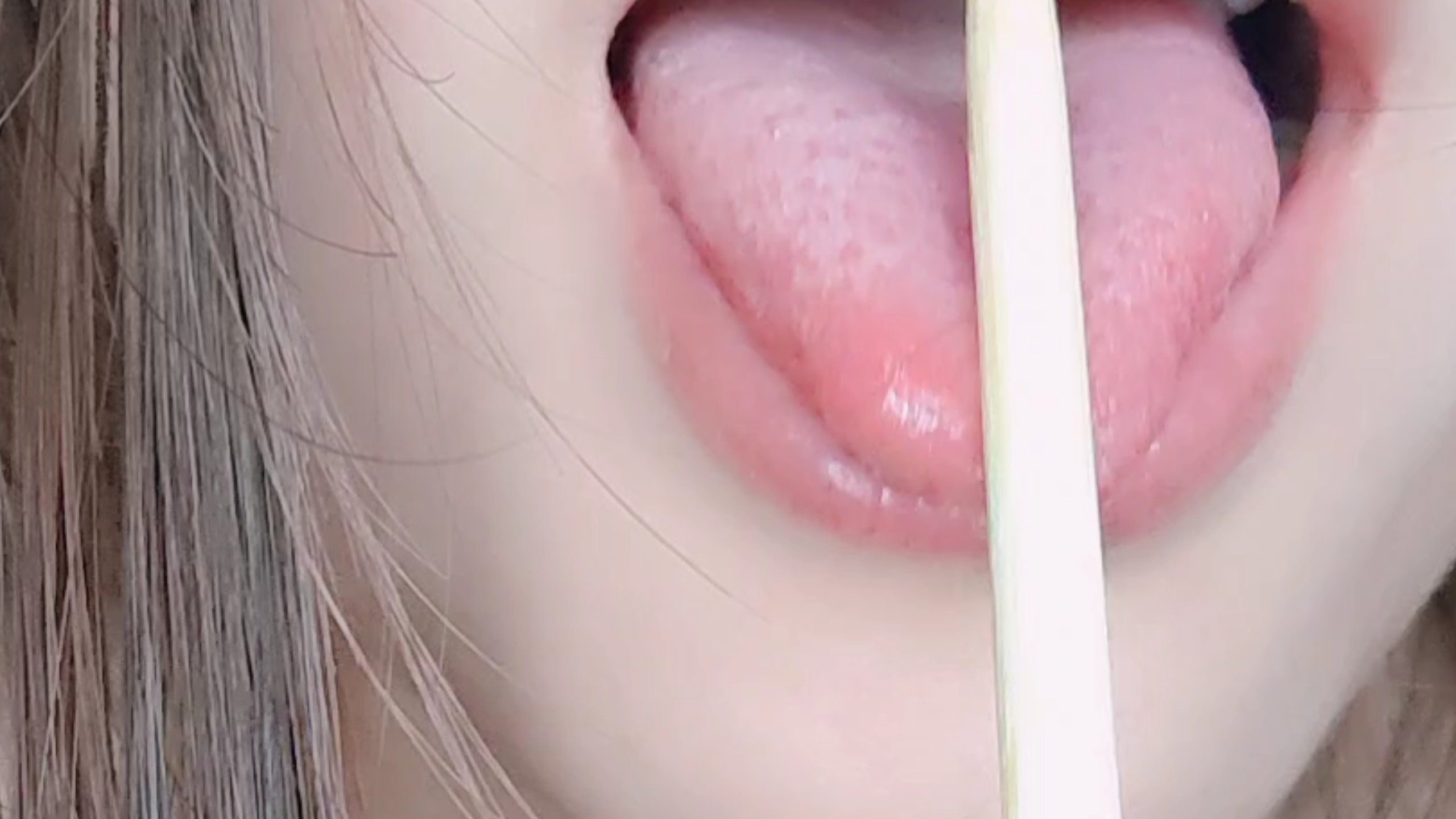 检查口腔有没有蛀牙
