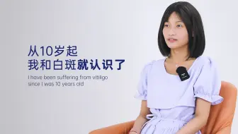 从10岁起,我和白斑就认识了.I have been suffering from vitiligo since I was 10 years old.