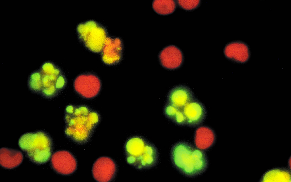 [图]Apoptosis 凋亡合集-王晓东教授