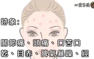 暗疮 搜索结果 哔哩哔哩 Bilibili