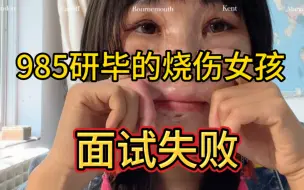 Tải video: 真是十分悲痛！请问烧伤女孩的就业市场究竟在何方？