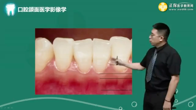 [图]口腔颌面部影像01