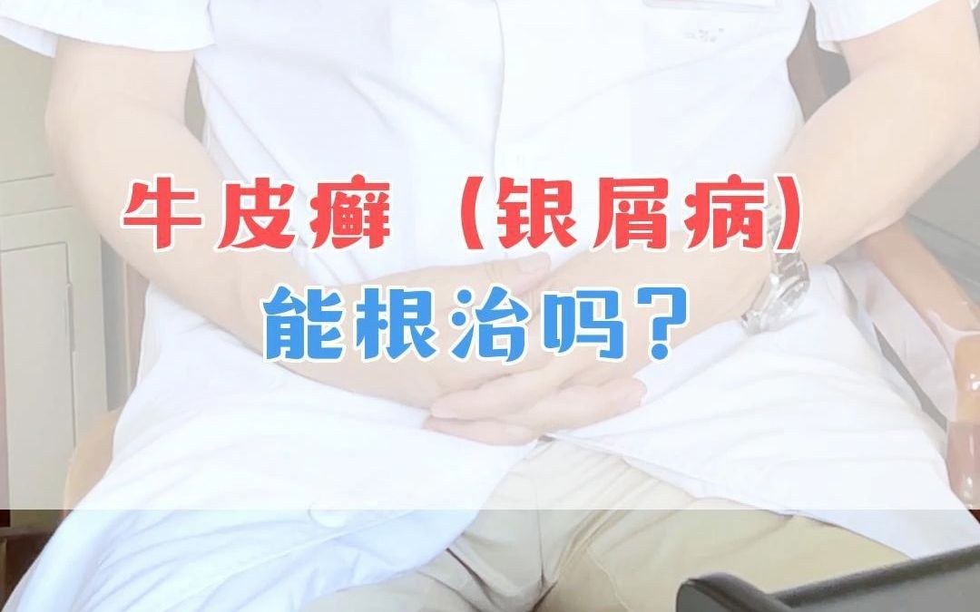 牛皮癣(银屑病)能根治吗?哔哩哔哩bilibili