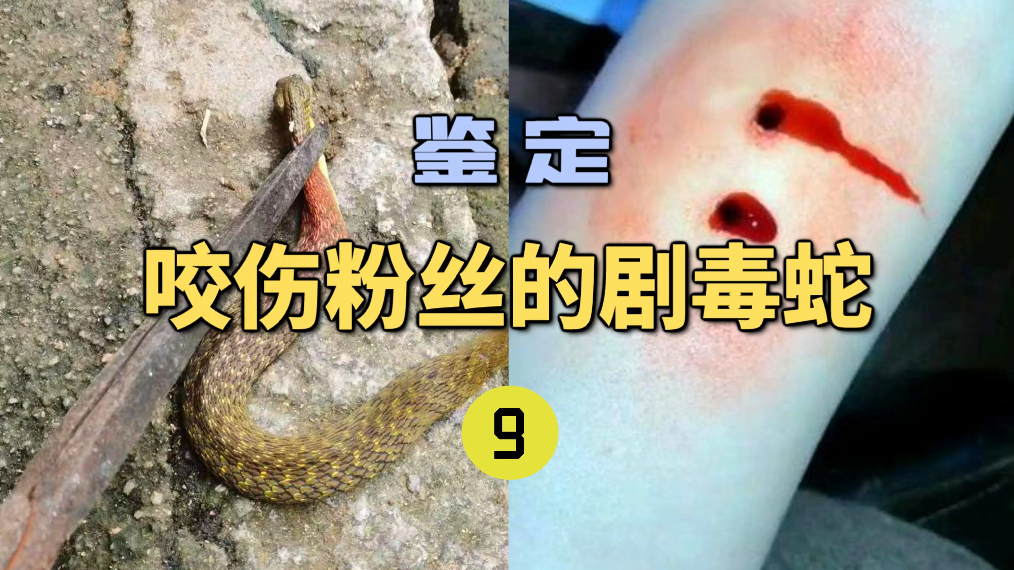 鉴定咬伤粉丝的毒蛇(9)网友被毒蛇咬伤！竟然拿网图来找龙雅鉴定？连伤口都是假的？_哔哩哔哩_bilibili