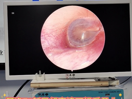 超高清可视采耳仪器高端耳镜可视耳镜内窥镜高清户外摆摊专用采耳机器