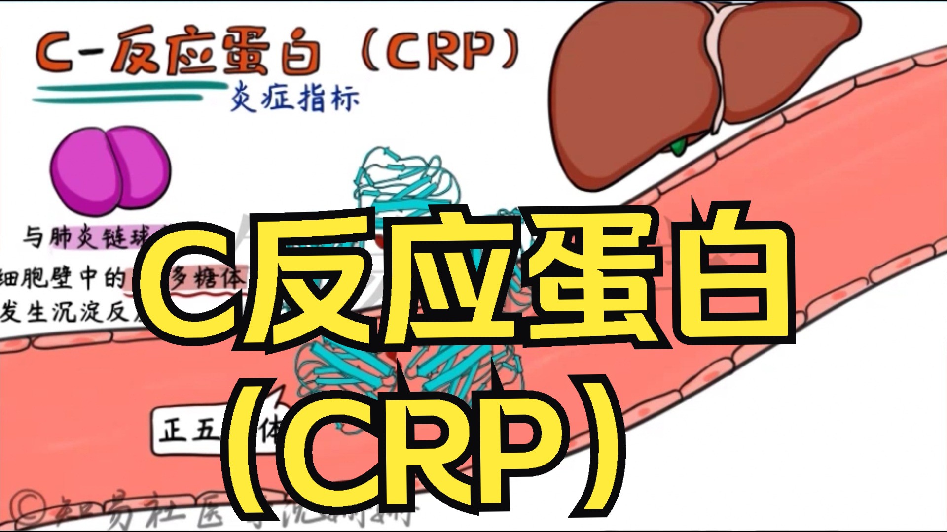 绘画医学 C反应蛋白(CRP)哔哩哔哩bilibili