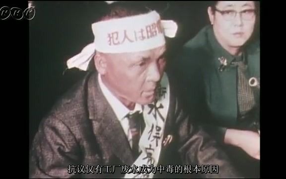 【开头抽搐病症预警】 日本水俣病专题 NHK放送 1956年1973年哔哩哔哩bilibili