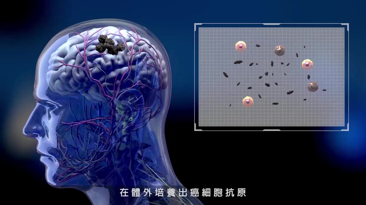 树突免疫治疗!cart细胞治疗!点击了解免疫治疗的两种疗法哔哩哔哩bilibili