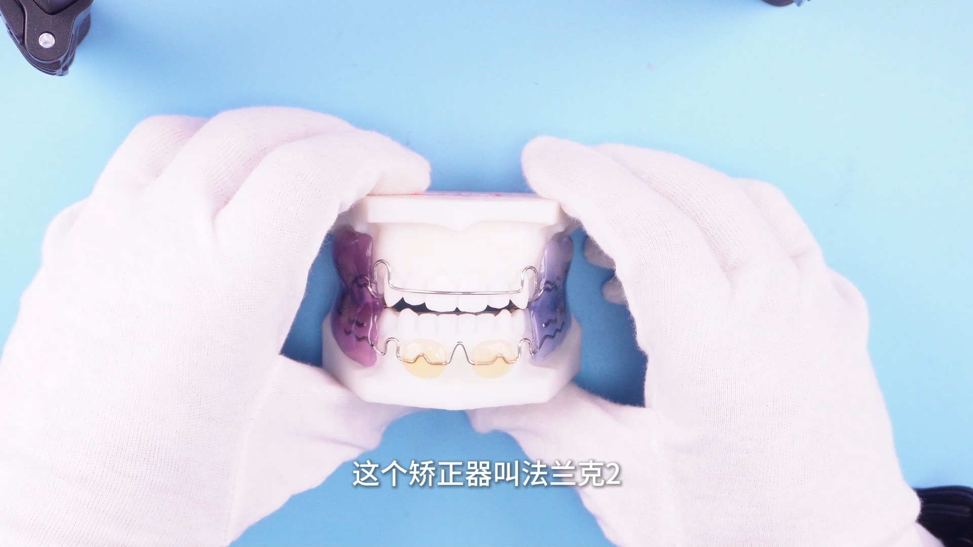 法兰克2 妃她正畸 儿童牙齿矫正器 活动矫正器