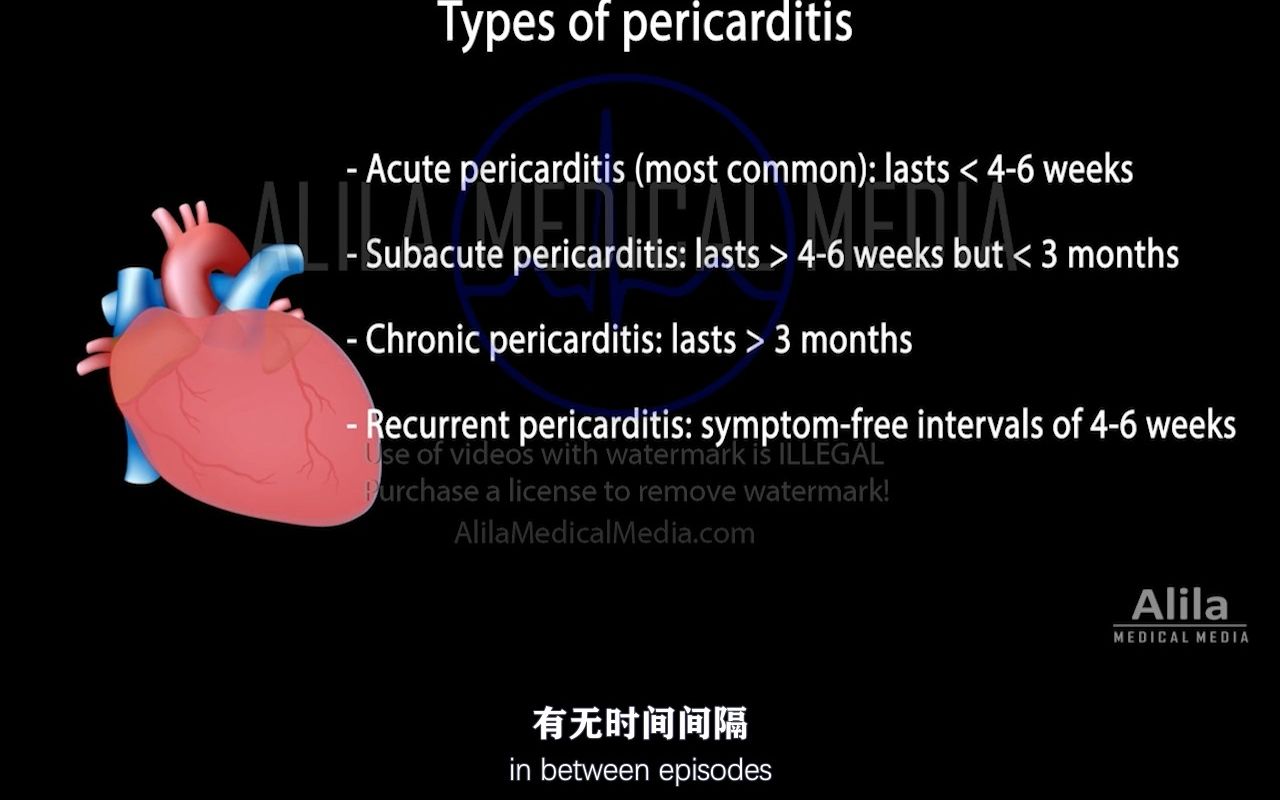 【Alila Medical Media】17.心包炎:症状、病理生理学、病因、诊断和治疗哔哩哔哩bilibili
