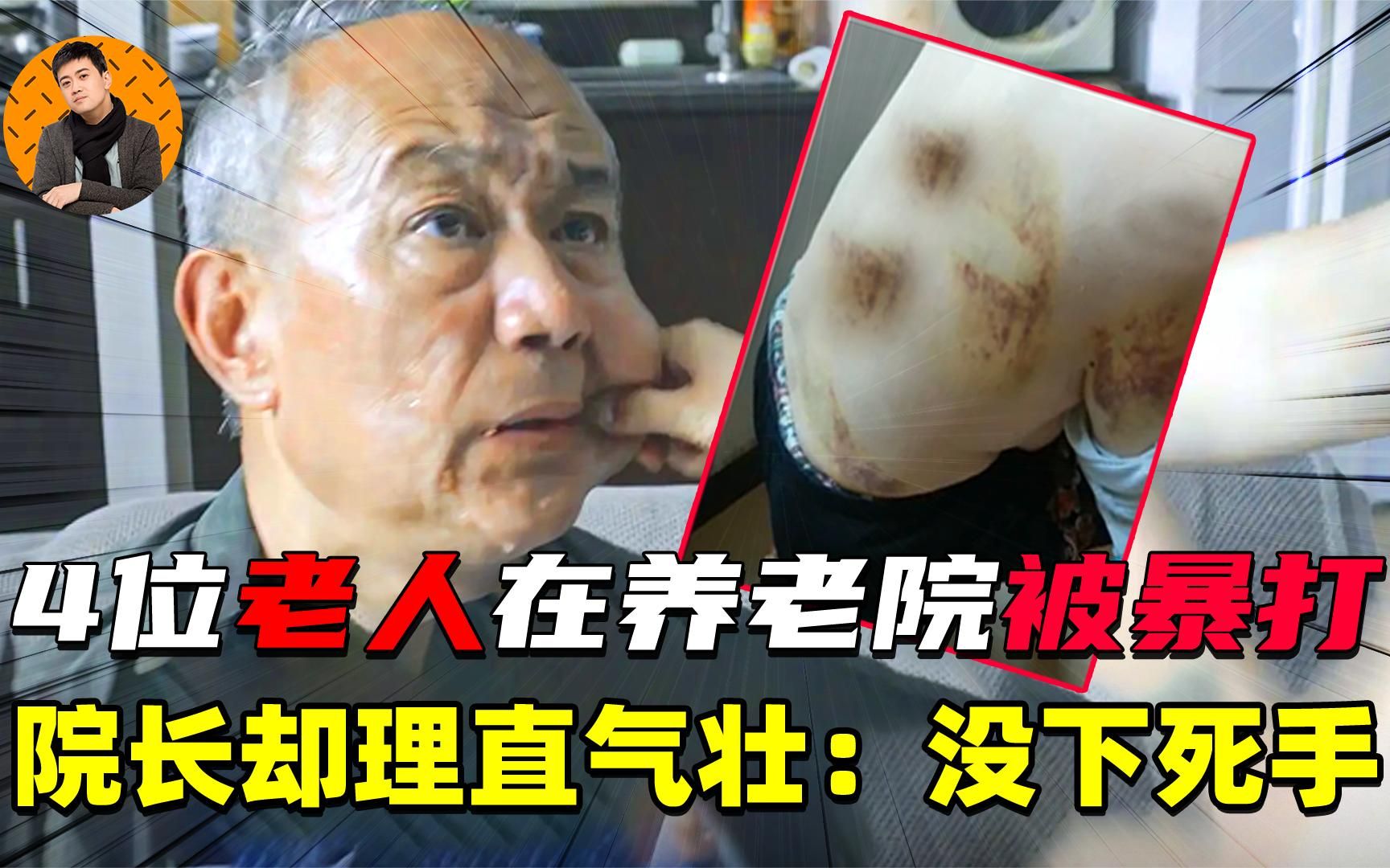 继唐山打人后,4位老人在养老院被暴打,院长却说,我下手很轻啦