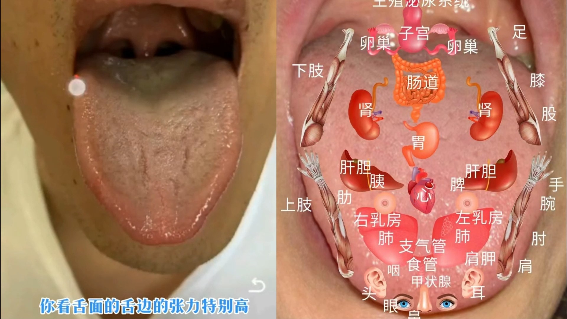 舌诊分析,可以进入我主页,看看简介