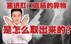 Download Video: 不小心“坐”进肛门的直肠异物，医生是怎么取出来的？