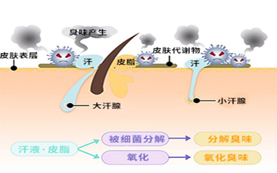 市面上常见的腋臭治疗方式有哪些?哔哩哔哩bilibili