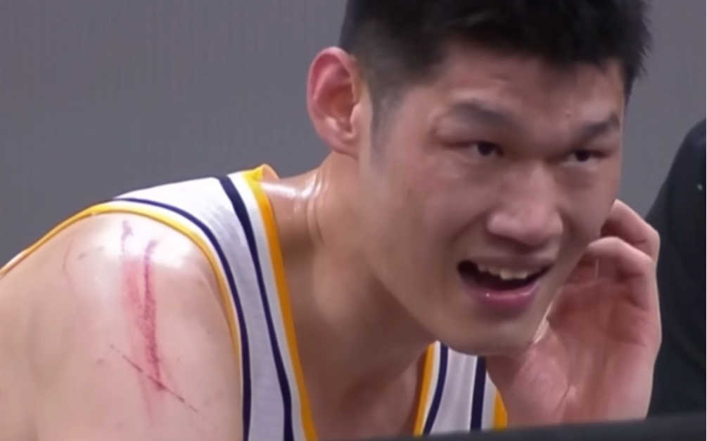 打球不剪指甲?胡金秋肩膀被抓伤